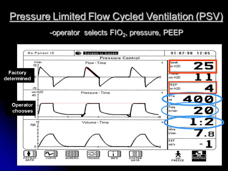 Pressure Limited Flow Cycled Ventilation (PSV)  -operator selects FIO2, pressure, PEEP Operator chooses